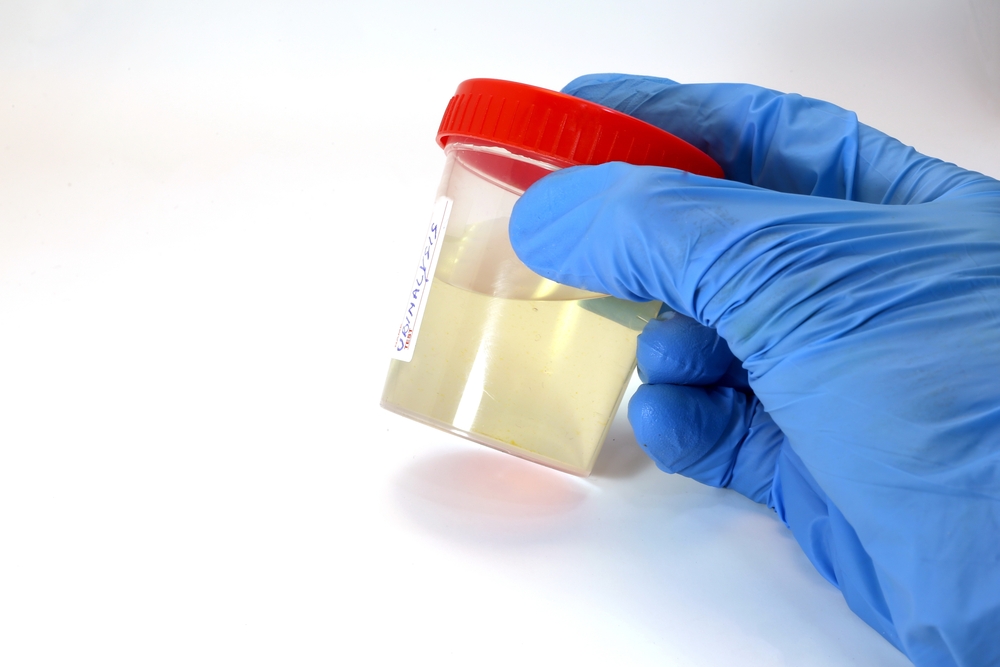 Kiderült, kik doppingolnak a legtöbbet