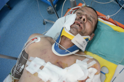 Súlyos medvetámadás volt Csíkszentkirályon (Videó)