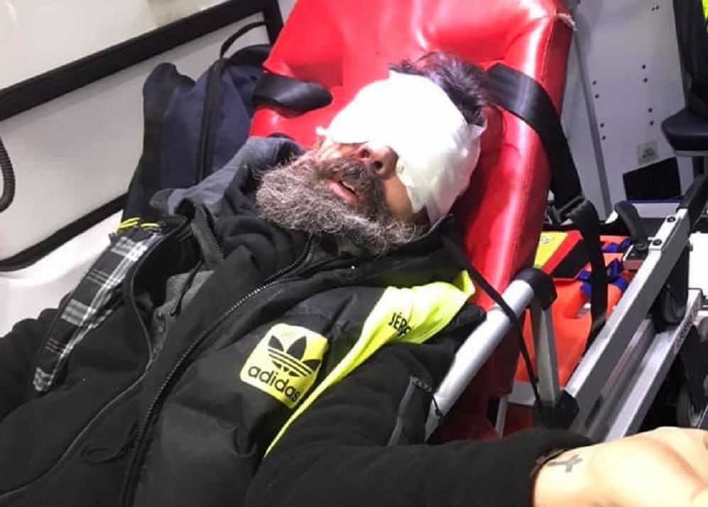 Francia vita a gumilövedékek használatáról