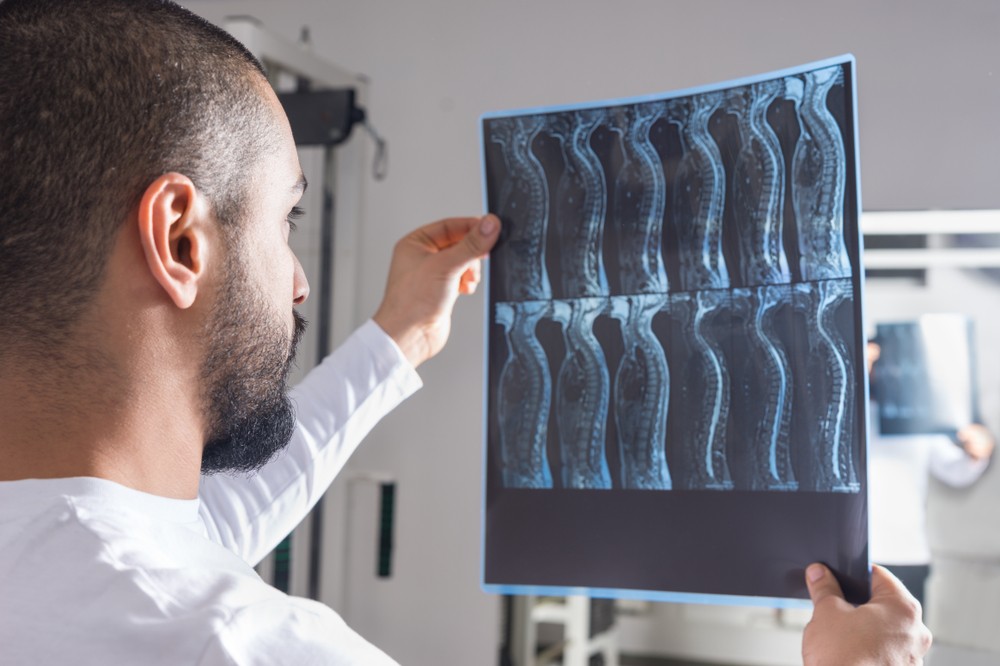 Visszafordíthatják a kar és a kéz bénultságát