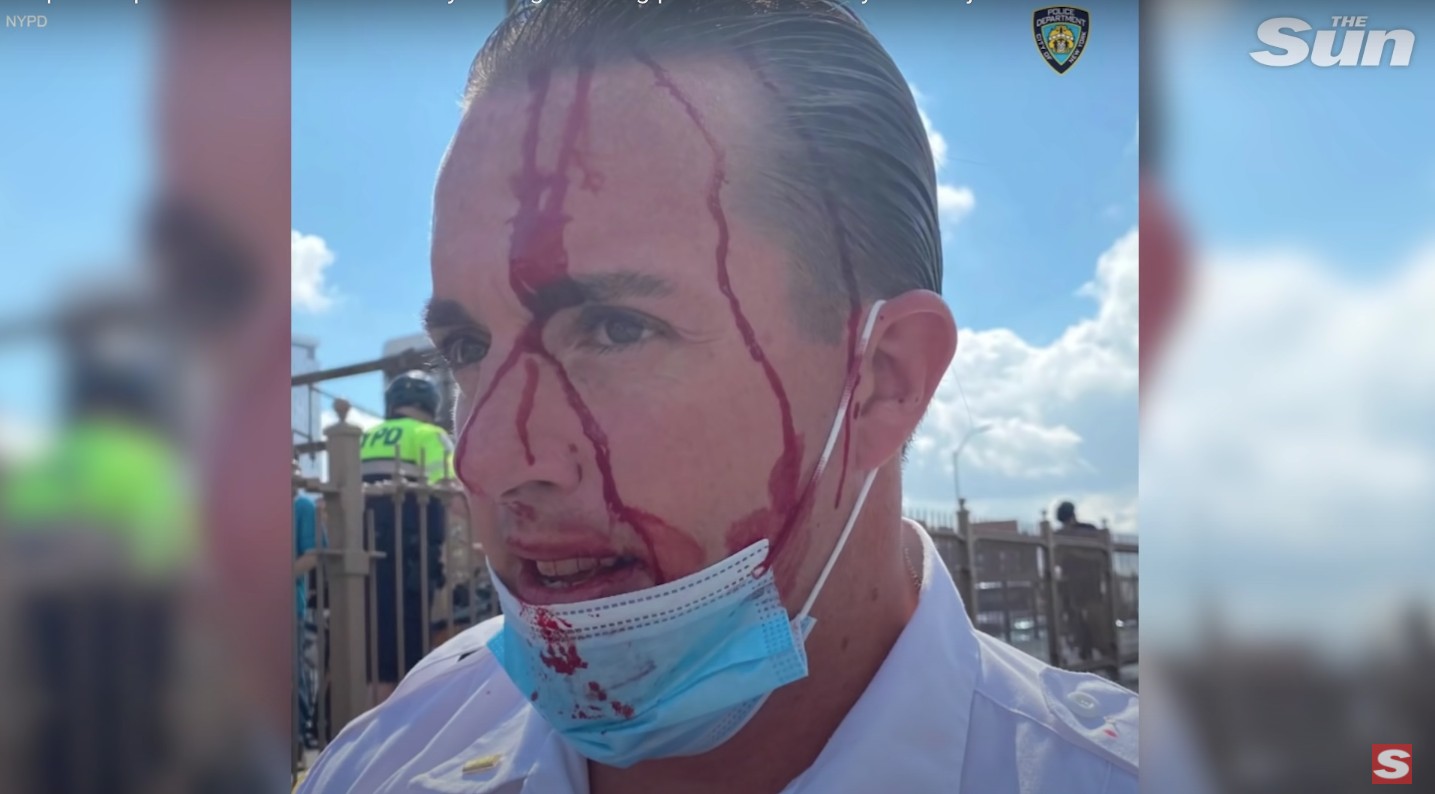 Szabadlábra helyezték a New York-i rendőrökre támadó nőt