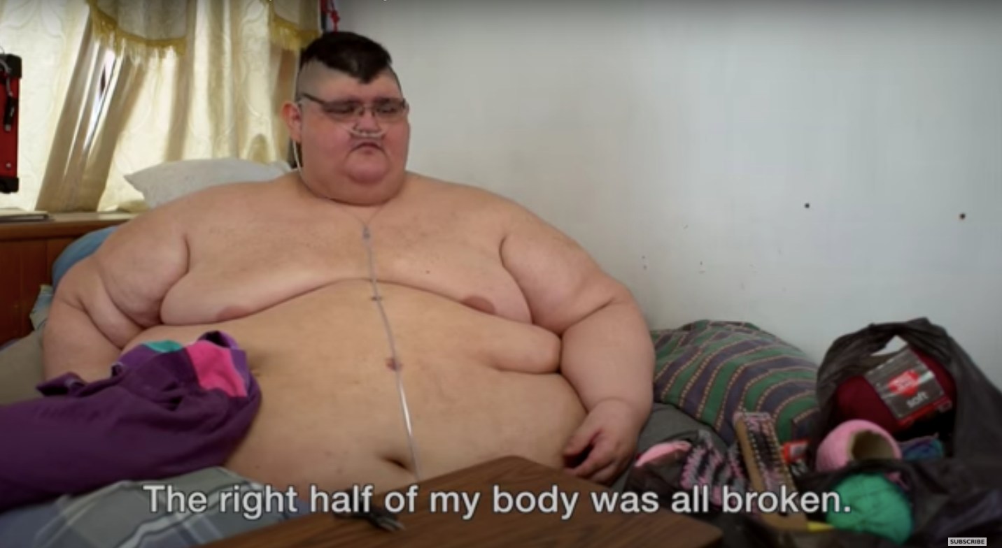 Felgyógyult a fertőzésből a világ egykor legkövérebb embere