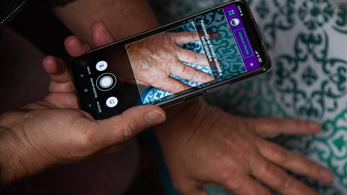 Bőrgyógyász a zsebünkben