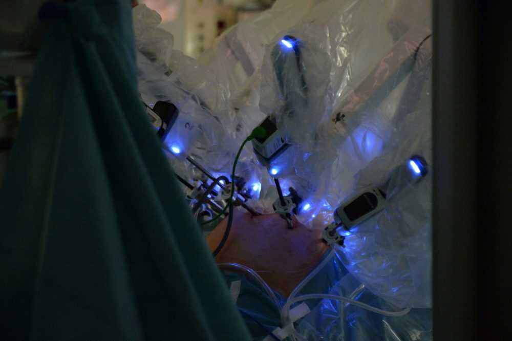 Kiemelkedő számú robotsebészeti beavatkozás az Országos Onkológiai Intézetben