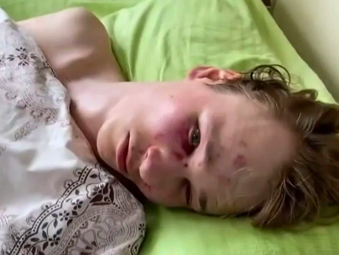 Az ukránok szerint magát verte meg egy fiú a kényszersorozáskor