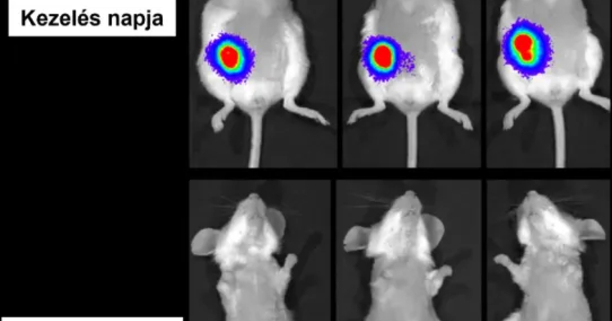 Magyar csoda a rákgyógyításban: az új szer teljesen eltüntette a daganatot!