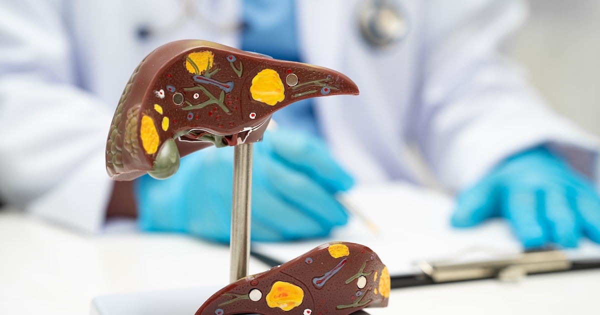 Vigyázz, itt a sárgaság!