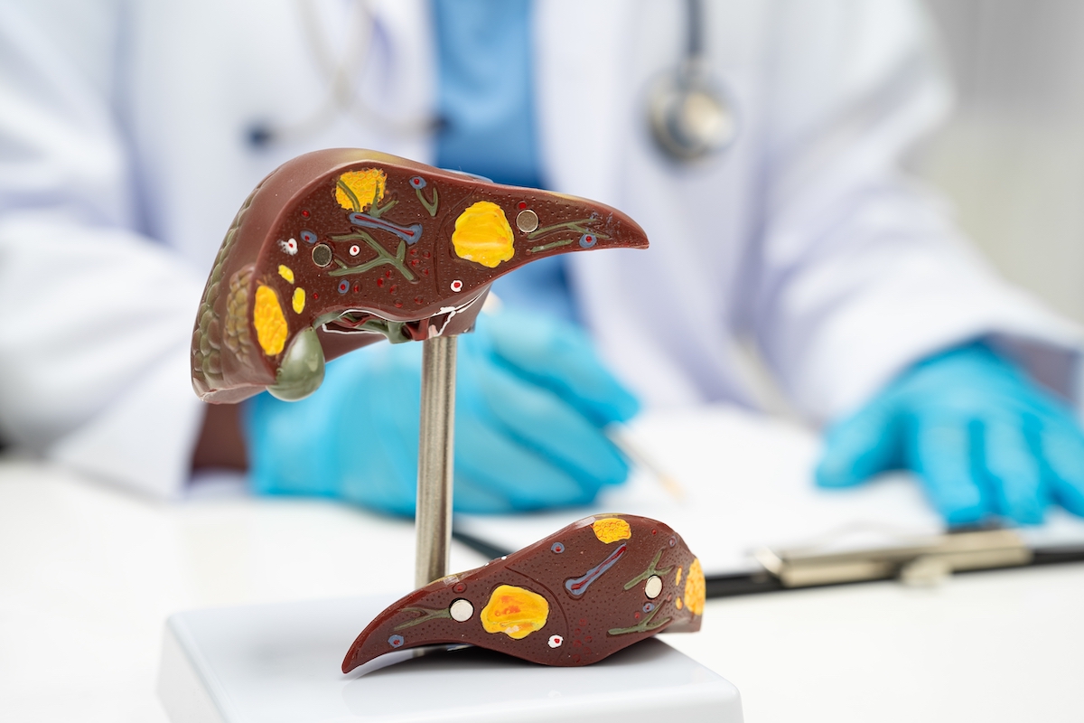 Vigyázz, itt a sárgaság!